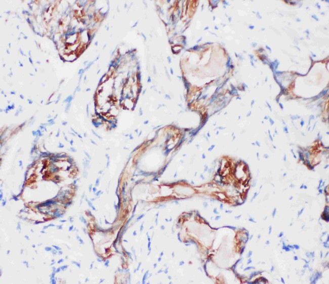 Kallikrein 2 Antibody in Immunohistochemistry (Paraffin) (IHC (P))