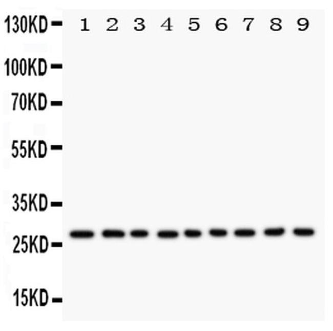 Kallikrein 6 Antibody in Western Blot (WB)