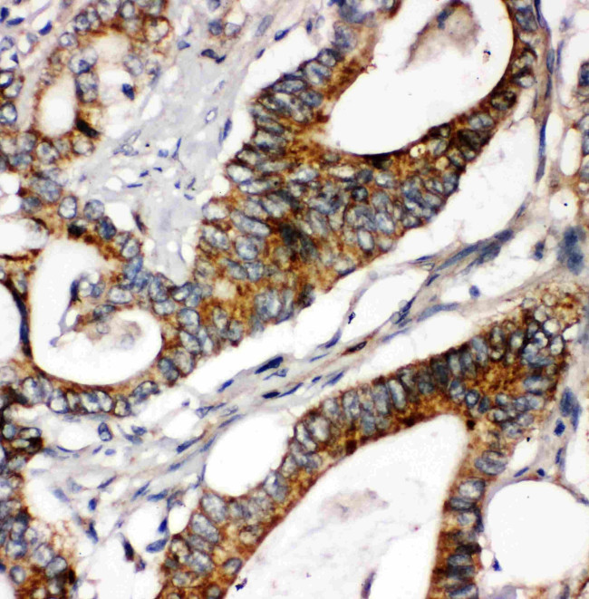 Laminin gamma-1 Antibody in Immunohistochemistry (Paraffin) (IHC (P))