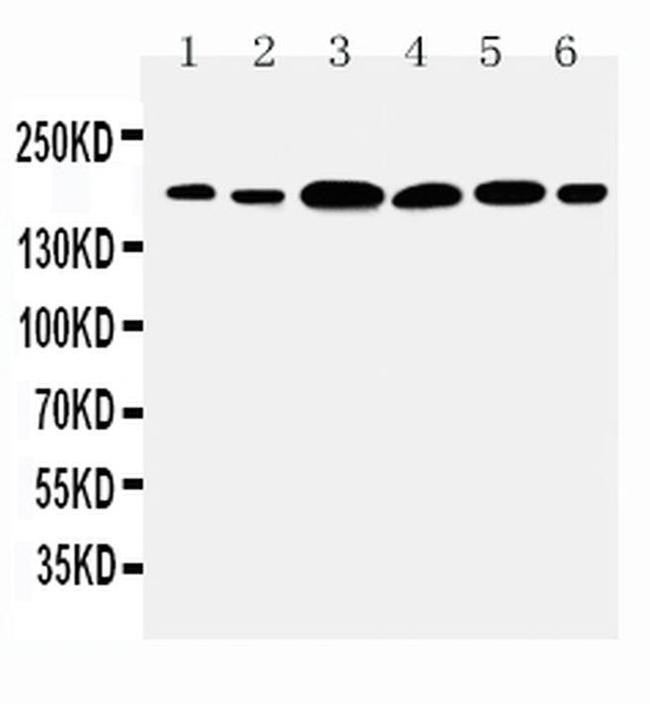 Laminin gamma-1 Antibody in Western Blot (WB)