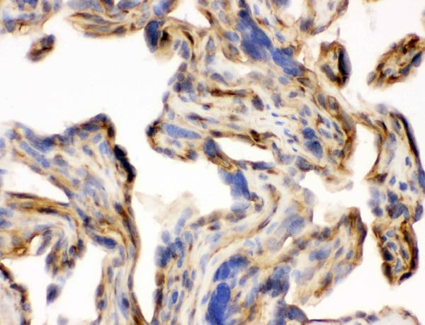 Laminin gamma-1,2,3 Antibody in Immunohistochemistry (Frozen) (IHC (F))