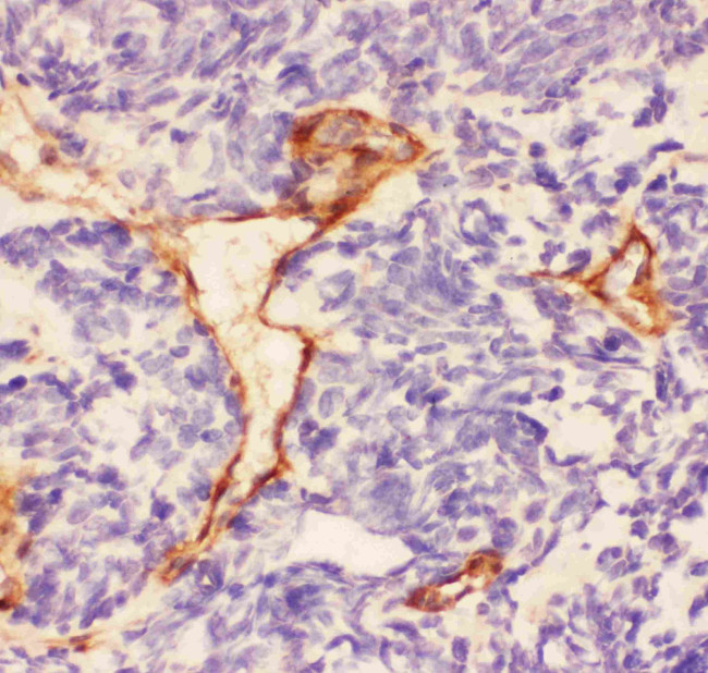 Laminin gamma-1,2,3 Antibody in Immunohistochemistry (Paraffin) (IHC (P))