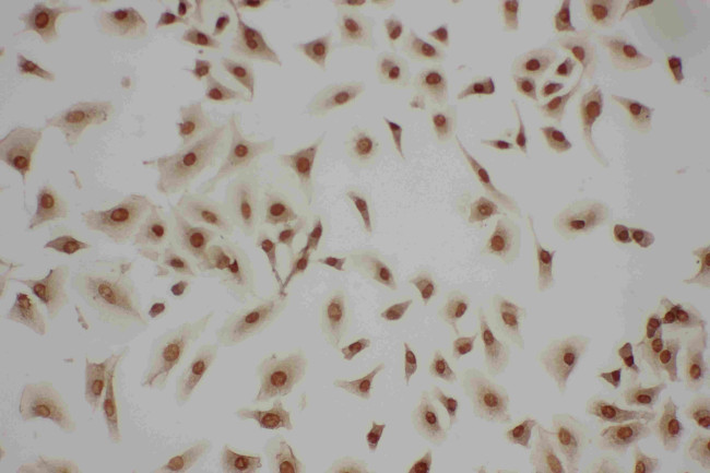 LASP1 Antibody in Immunocytochemistry (ICC/IF)