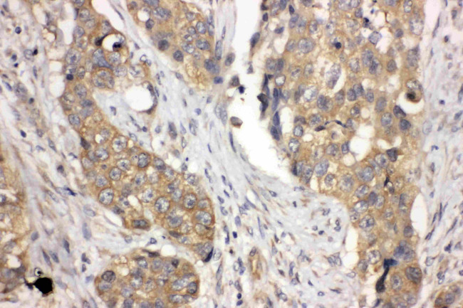 LASP1 Antibody in Immunohistochemistry (Paraffin) (IHC (P))