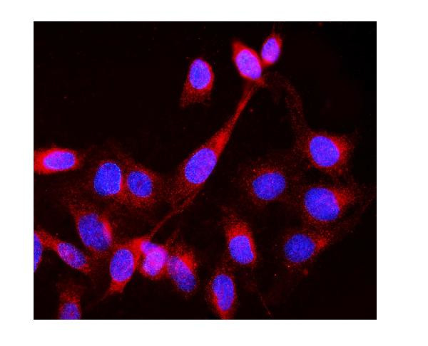 LCK Antibody in Immunocytochemistry (ICC/IF)