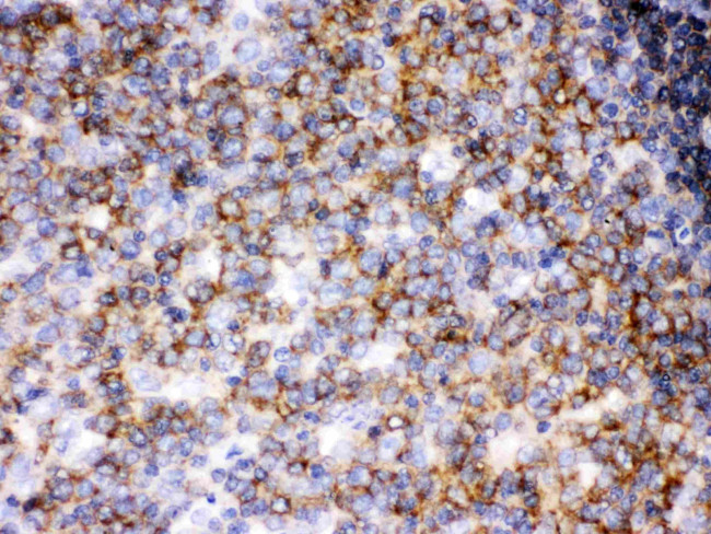 LCK Antibody in Immunohistochemistry (Paraffin) (IHC (P))