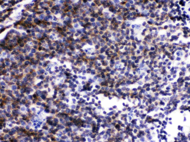 LCK Antibody in Immunohistochemistry (Paraffin) (IHC (P))