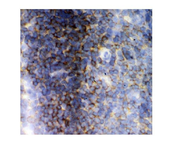 LCK Antibody in Immunohistochemistry (Frozen) (IHC (F))