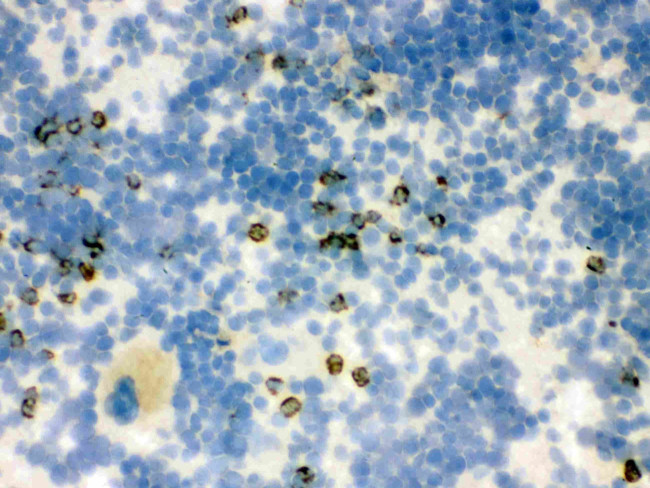 NGAL Antibody in Immunohistochemistry (Frozen) (IHC (F))