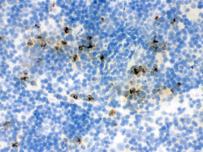 NGAL Antibody in Immunohistochemistry (Frozen) (IHC (F))