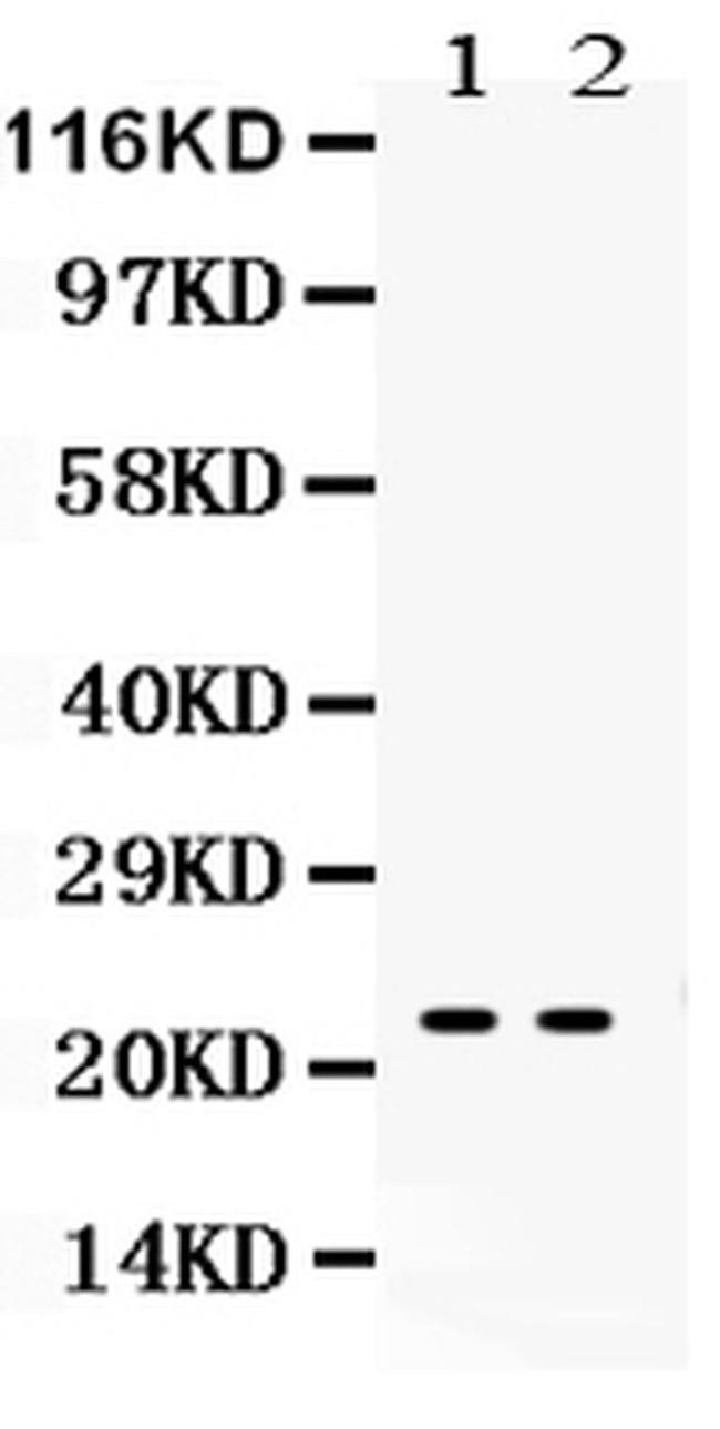 NGAL Antibody in Western Blot (WB)