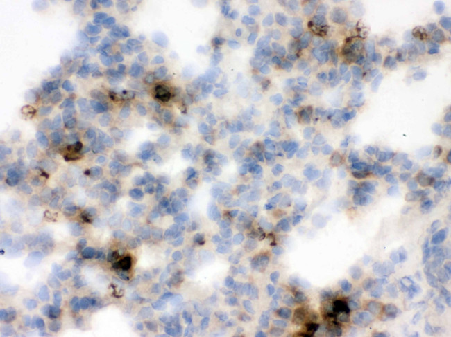 NGAL Antibody in Immunohistochemistry (Frozen) (IHC (F))