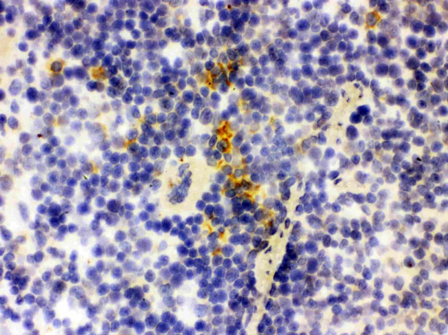 NGAL Antibody in Immunohistochemistry (Frozen) (IHC (F))