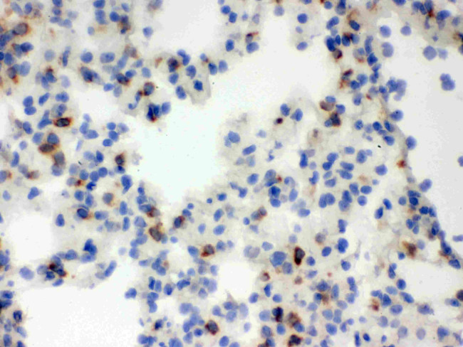 NGAL Antibody in Immunohistochemistry (Frozen) (IHC (F))