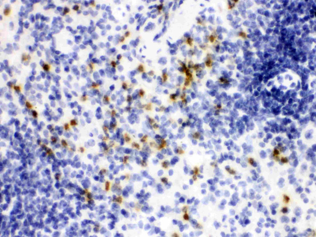 NGAL Antibody in Immunohistochemistry (Paraffin) (IHC (P))