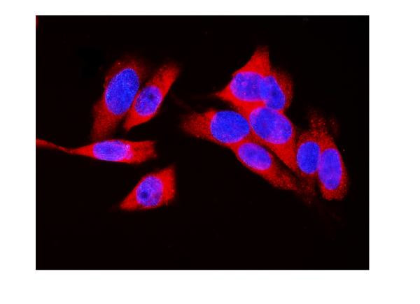 LDHA Antibody in Immunocytochemistry (ICC/IF)