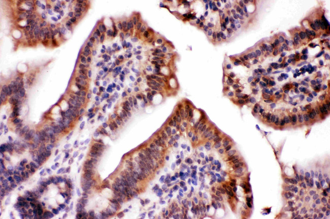 LDHA Antibody in Immunohistochemistry (Paraffin) (IHC (P))