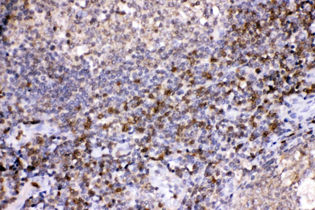 LDHB Antibody in Immunohistochemistry (Paraffin) (IHC (P))