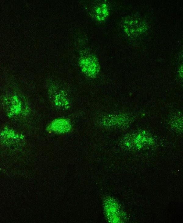 Galectin 3 Antibody in Immunocytochemistry (ICC/IF)