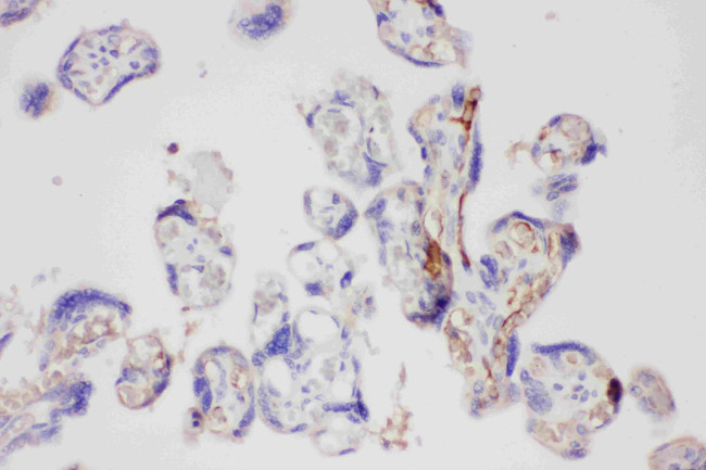 Galectin 3 Antibody in Immunohistochemistry (Paraffin) (IHC (P))