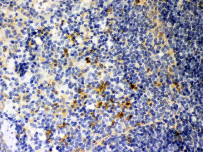 Galectin 3 Antibody in Immunohistochemistry (Paraffin) (IHC (P))