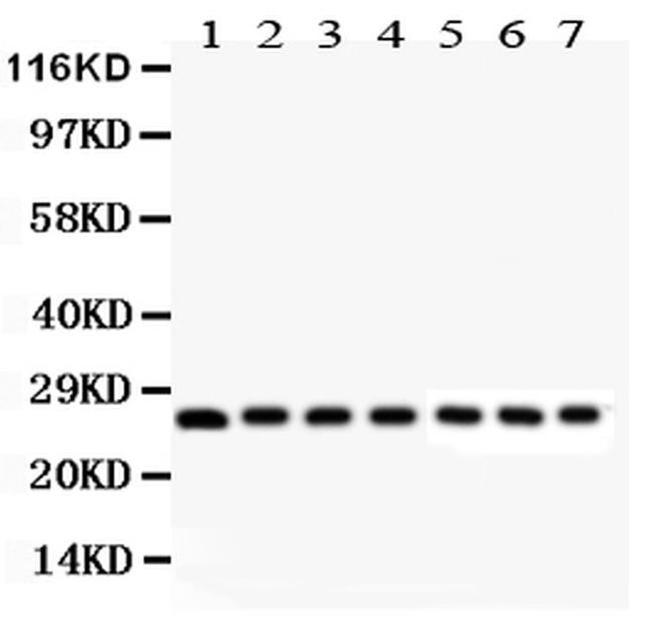 Galectin 3 Antibody in Western Blot (WB)