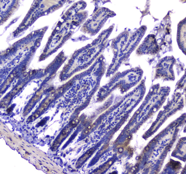 LGALS3BP Antibody in Immunohistochemistry (Paraffin) (IHC (P))