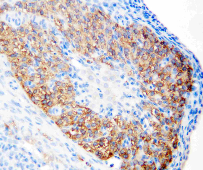 LHR Antibody in Immunohistochemistry (Paraffin) (IHC (P))