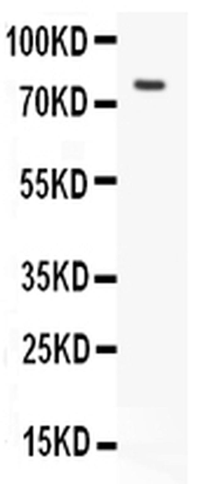 LHR Antibody in Western Blot (WB)