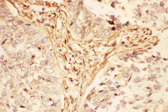 LIF Antibody in Immunohistochemistry (Paraffin) (IHC (P))