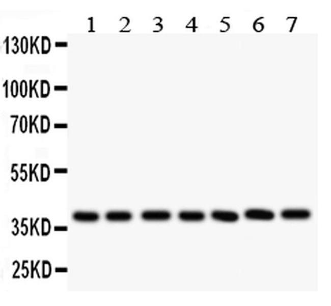 LIF Antibody in Western Blot (WB)