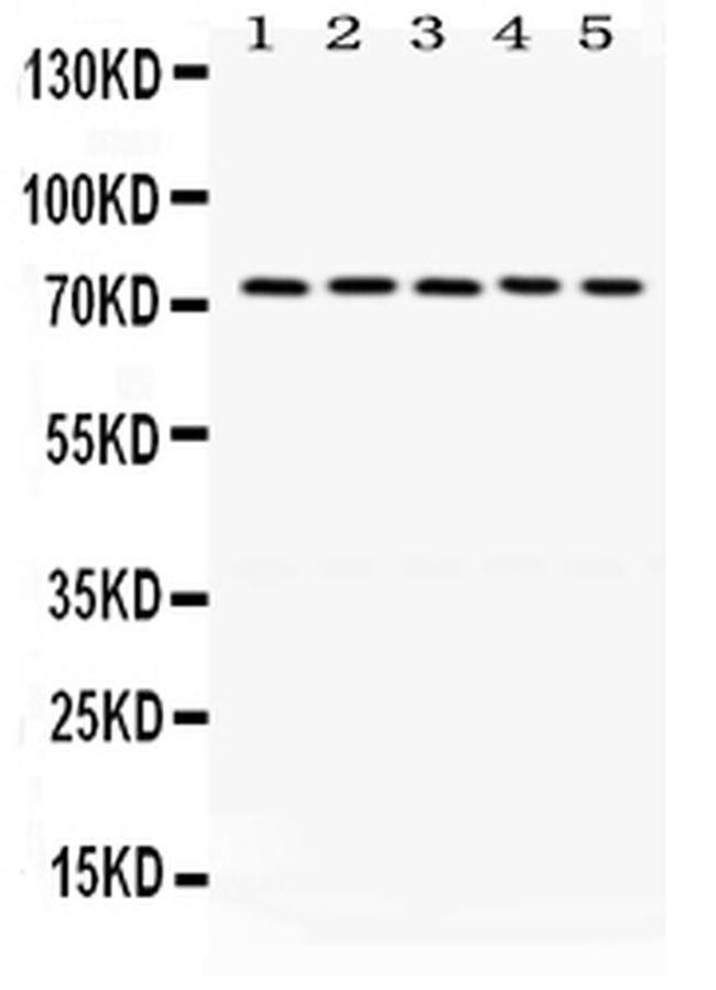 LIMK1 Antibody in Western Blot (WB)