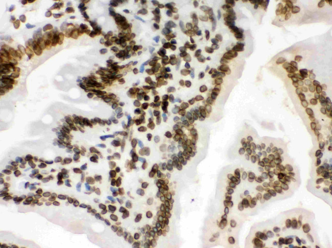 Lamin B1 Antibody in Immunohistochemistry (Paraffin) (IHC (P))