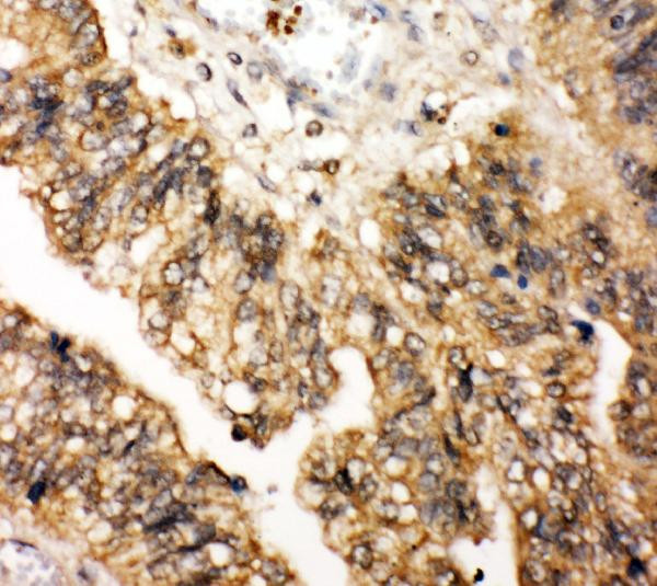 LPXN Antibody in Immunohistochemistry (Paraffin) (IHC (P))