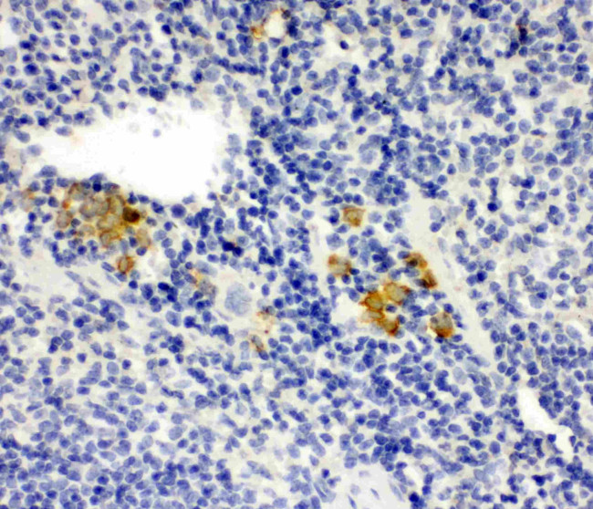 LPXN Antibody in Immunohistochemistry (Paraffin) (IHC (P))