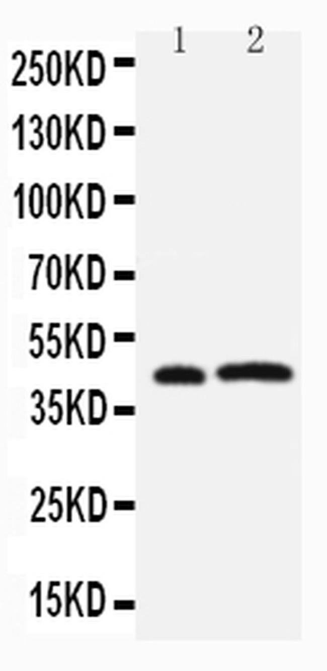 LPXN Antibody in Western Blot (WB)