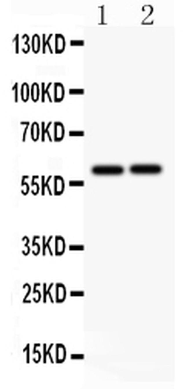 LTBR Antibody in Western Blot (WB)