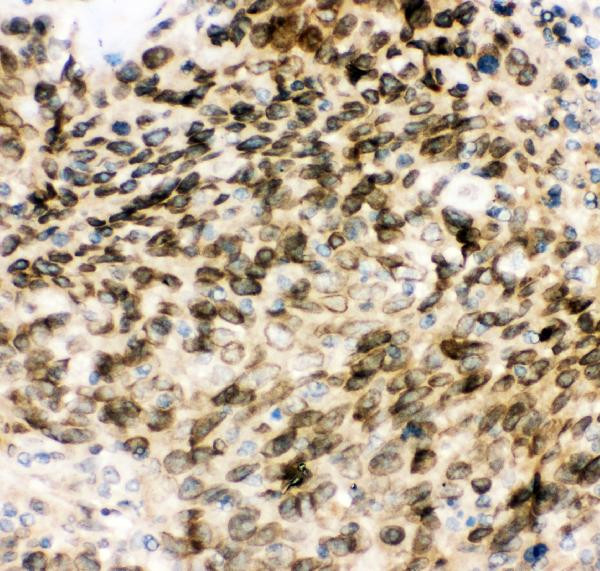 MAD1 Antibody in Immunohistochemistry (Paraffin) (IHC (P))