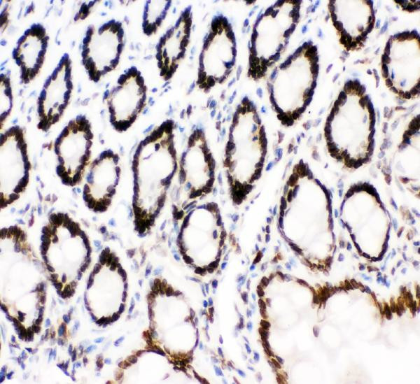 MAD1 Antibody in Immunohistochemistry (Paraffin) (IHC (P))