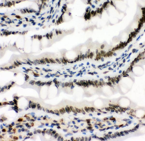 MAD1 Antibody in Immunohistochemistry (Paraffin) (IHC (P))