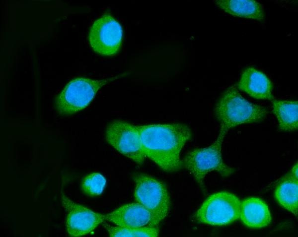 MEK3 Antibody in Immunocytochemistry (ICC/IF)