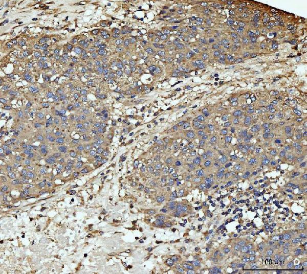 MEK3 Antibody in Immunohistochemistry (Paraffin) (IHC (P))