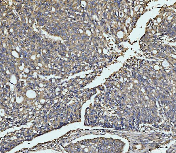 MEK3 Antibody in Immunohistochemistry (Paraffin) (IHC (P))