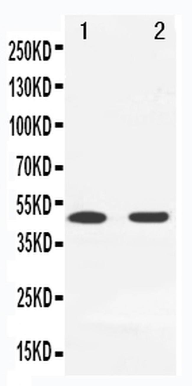 MKK7 Antibody in Western Blot (WB)