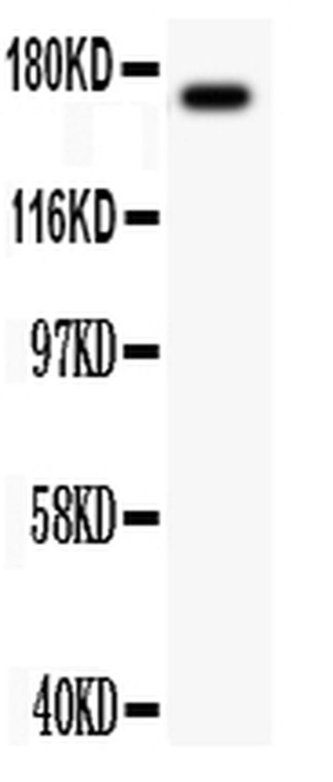 MEKK1 Antibody in Western Blot (WB)