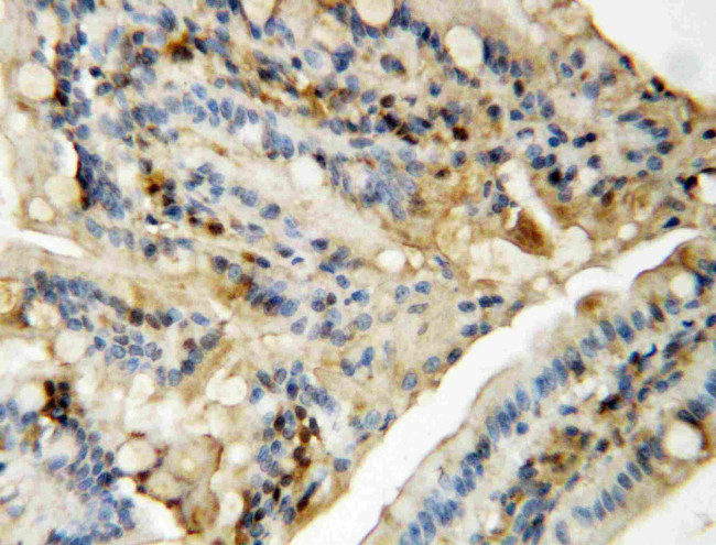 JNK1/JNK2 Antibody in Immunohistochemistry (Paraffin) (IHC (P))