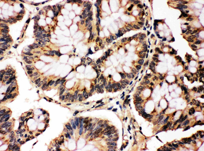 JNK1/JNK2 Antibody in Immunohistochemistry (Paraffin) (IHC (P))