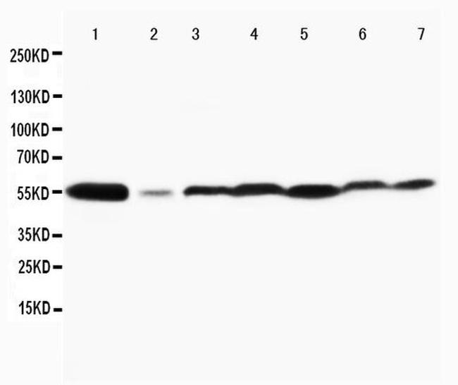 JNK1/JNK2 Antibody in Western Blot (WB)