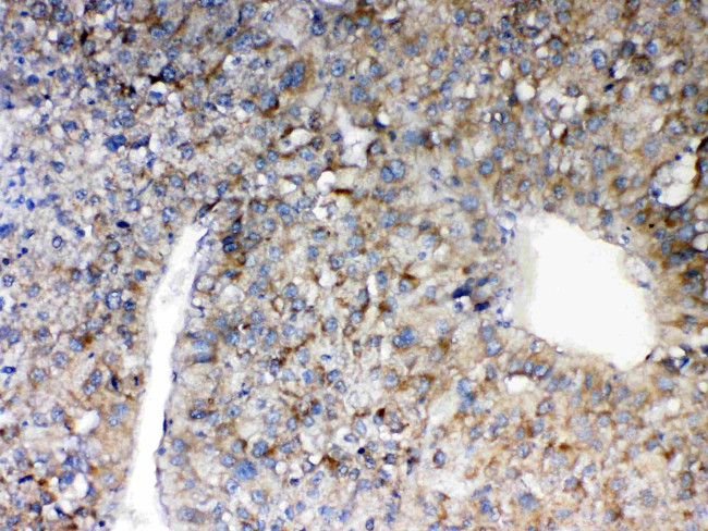 MAVS Antibody in Immunohistochemistry (Paraffin) (IHC (P))