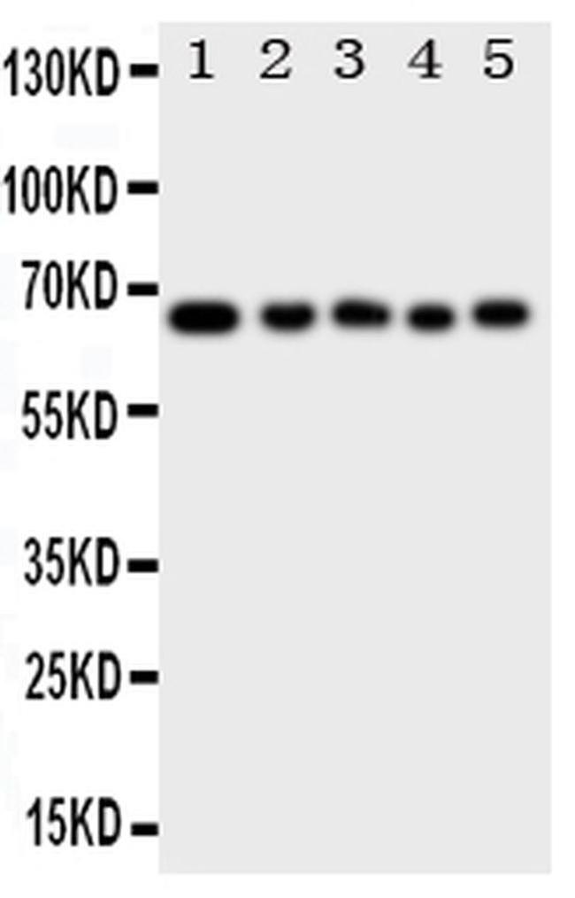 MBD4 Antibody in Western Blot (WB)